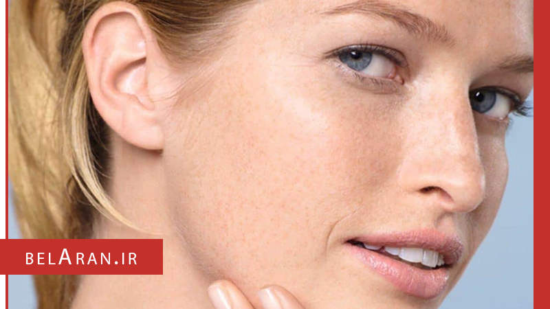 عوارض مصرف بیش از حد تونر پوست را هم بدانیم - بلاران